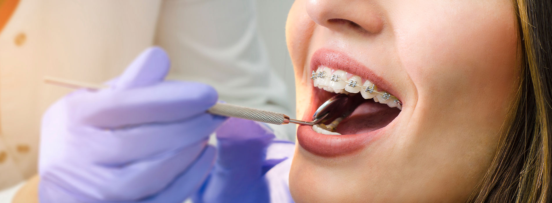 The image shows a person receiving dental treatment, with a focus on the dental chair and the dental professional s hands working on the patient s mouth.
